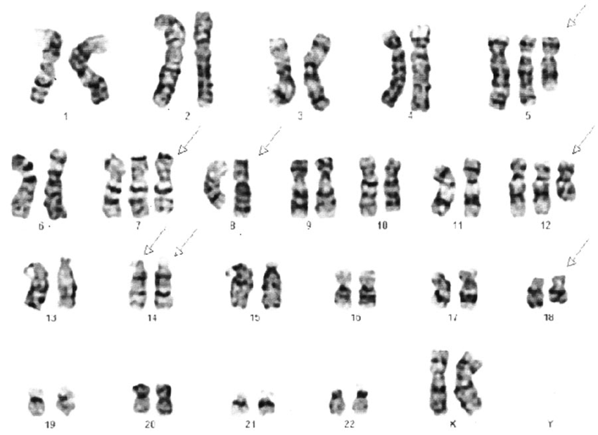 Chromosome analysis of chicken quail and chicken quail hybrids biology essay 06 picture